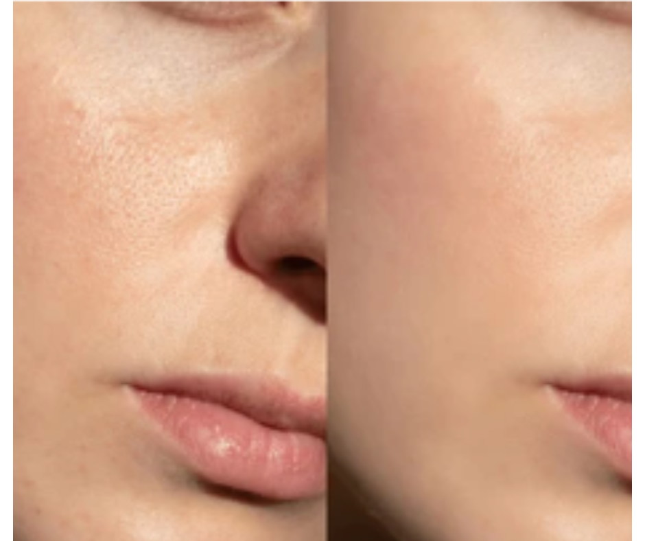 Dr. Collagen PRO Face CELLULAR REPAIR Mask (PACK of 4)